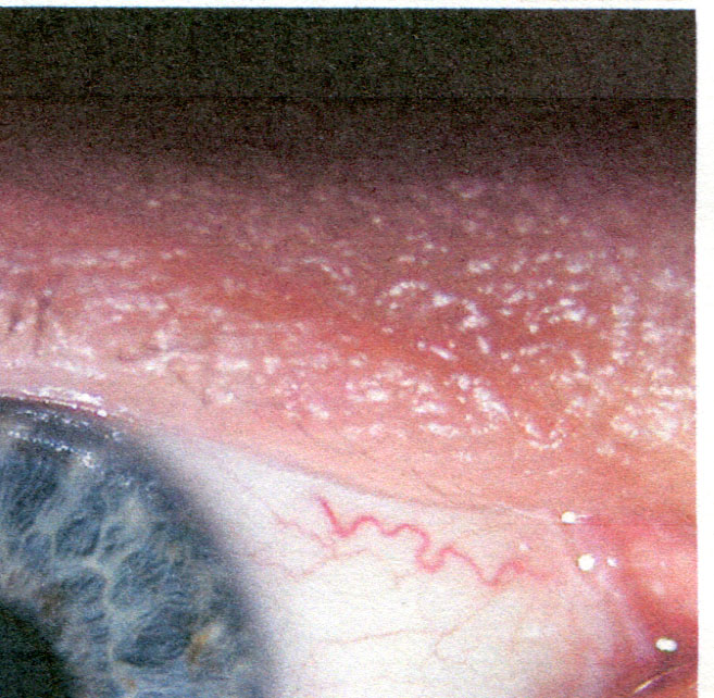 korrekt mit "TP-normal"-Einstellung gedruckt